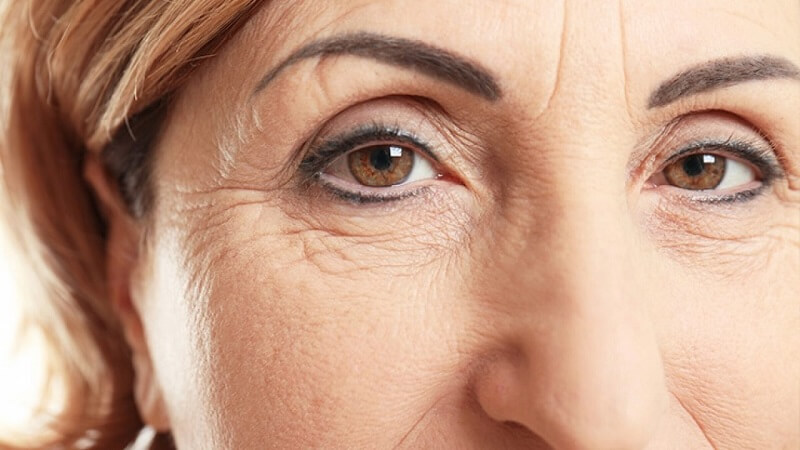 Nếp nhăn là dấu hiệu lão hóa dễ nhận biết trên gương mặt